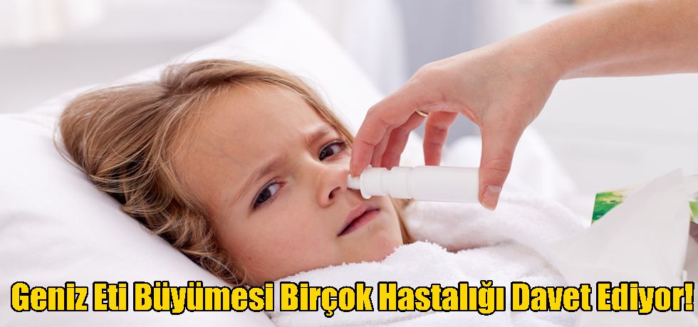 Geniz Eti Büyümesi Birçok Hastalığı Davet Ediyor!