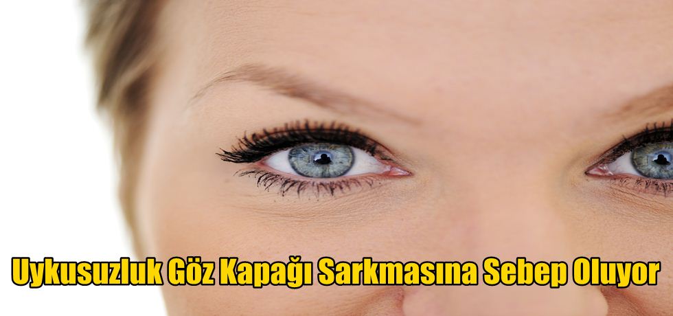 Uykusuzluk Göz Kapağı Sarkmasına Sebep Oluyor